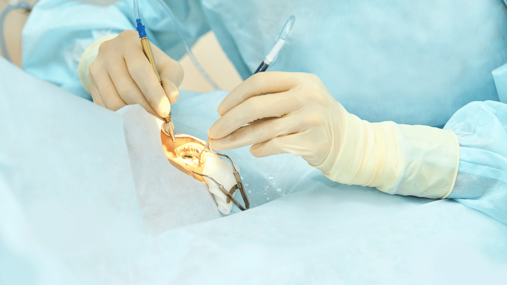 Cirugía de los ojos y procedimientos en Fundonal