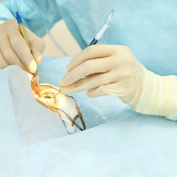 Cirugía de los ojos y procedimientos en Fundonal