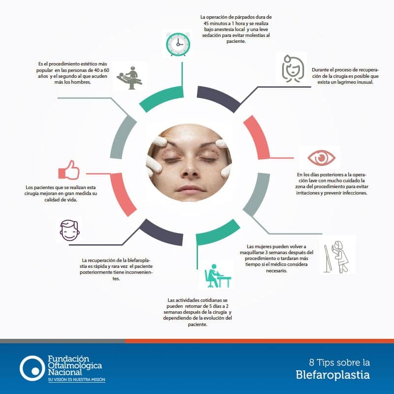 8 tips sobre la blefaroplastia - Fundación Oftalmológica Nacional en ...
