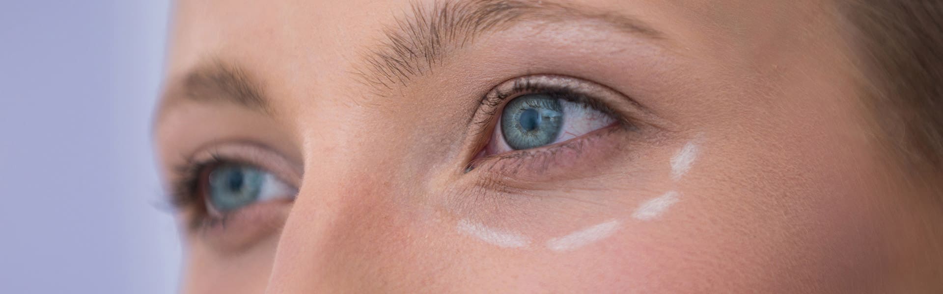 Blefaroplastia - Cirugía Estética de Párpados - Fundonal