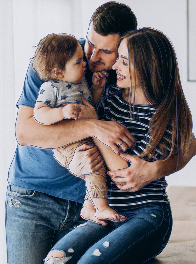 Cirugía de Estrabismo - Fundonal