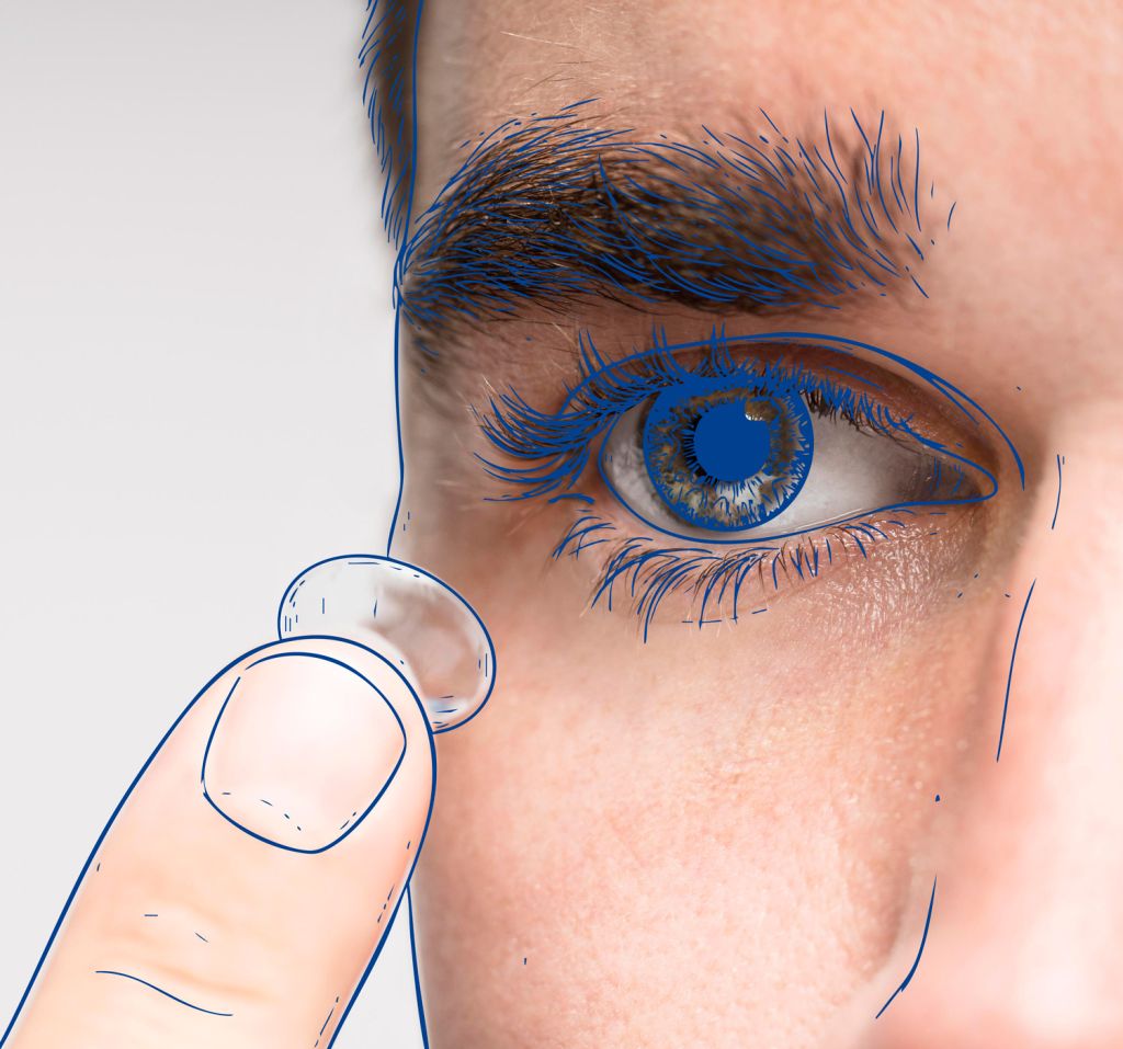 Contactología - Fundonal