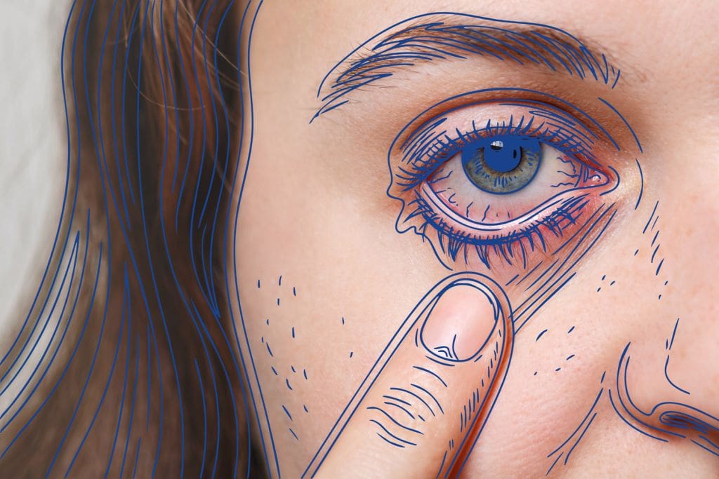 Especialidad en uveítis - Fundonal